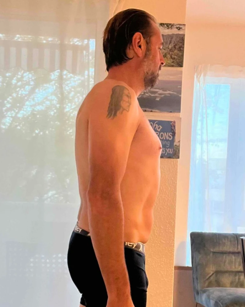 Nachher: Thorsten, 49